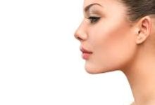 Rhinoplasty