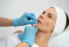 How Long Does It Take to See Results from Juvederm Fillers